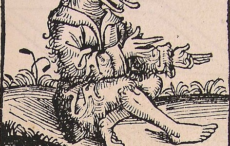 Cynocephaly