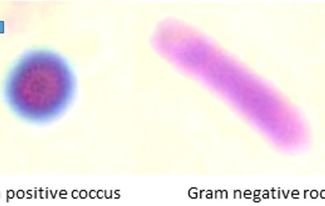 Gram stain